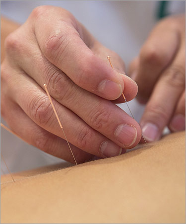 Acupuncturist in Sandton